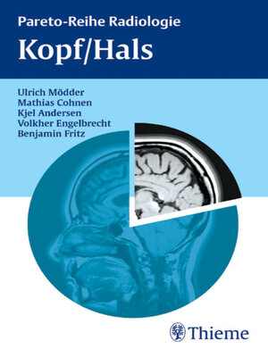 cover image of Kopf/Hals